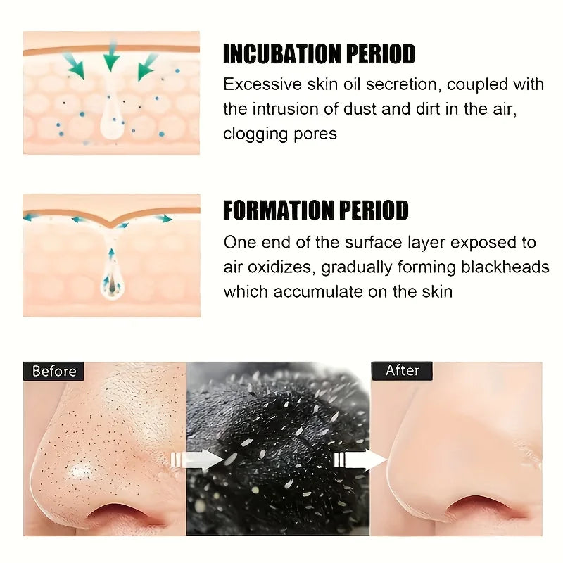Alcohol-Free Nose Cleaning Strips – Deep Cleansing Pore Patches for Excess Oil Removal  Refined Skin, Mild  Fragrance-Free